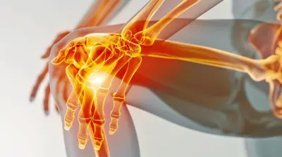 How to Care for Your Joints After Intense Workouts