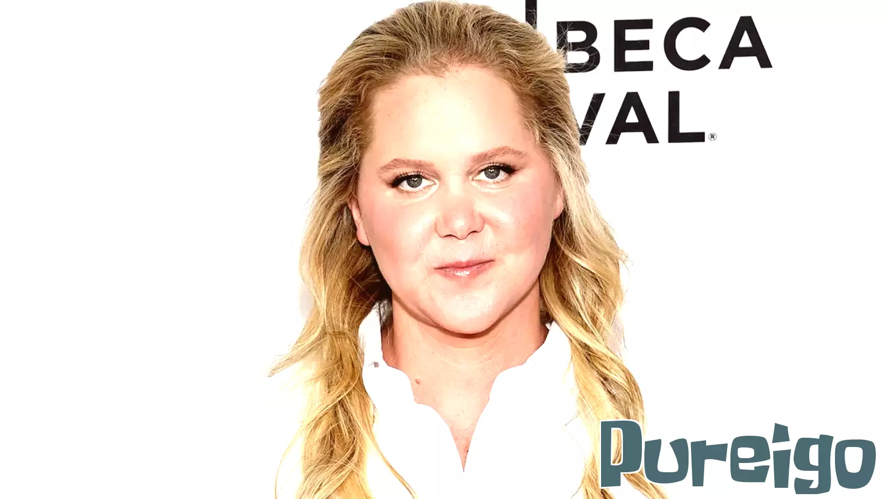 Amy Schumer Provides Health Update After Recent Back Surgery