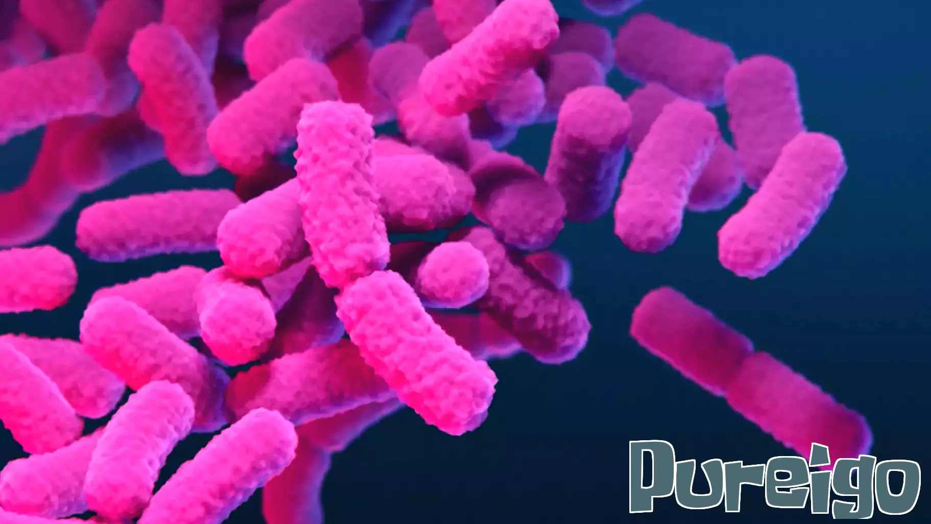 Another global health crisis is gaining momentum. We need to be prepared.