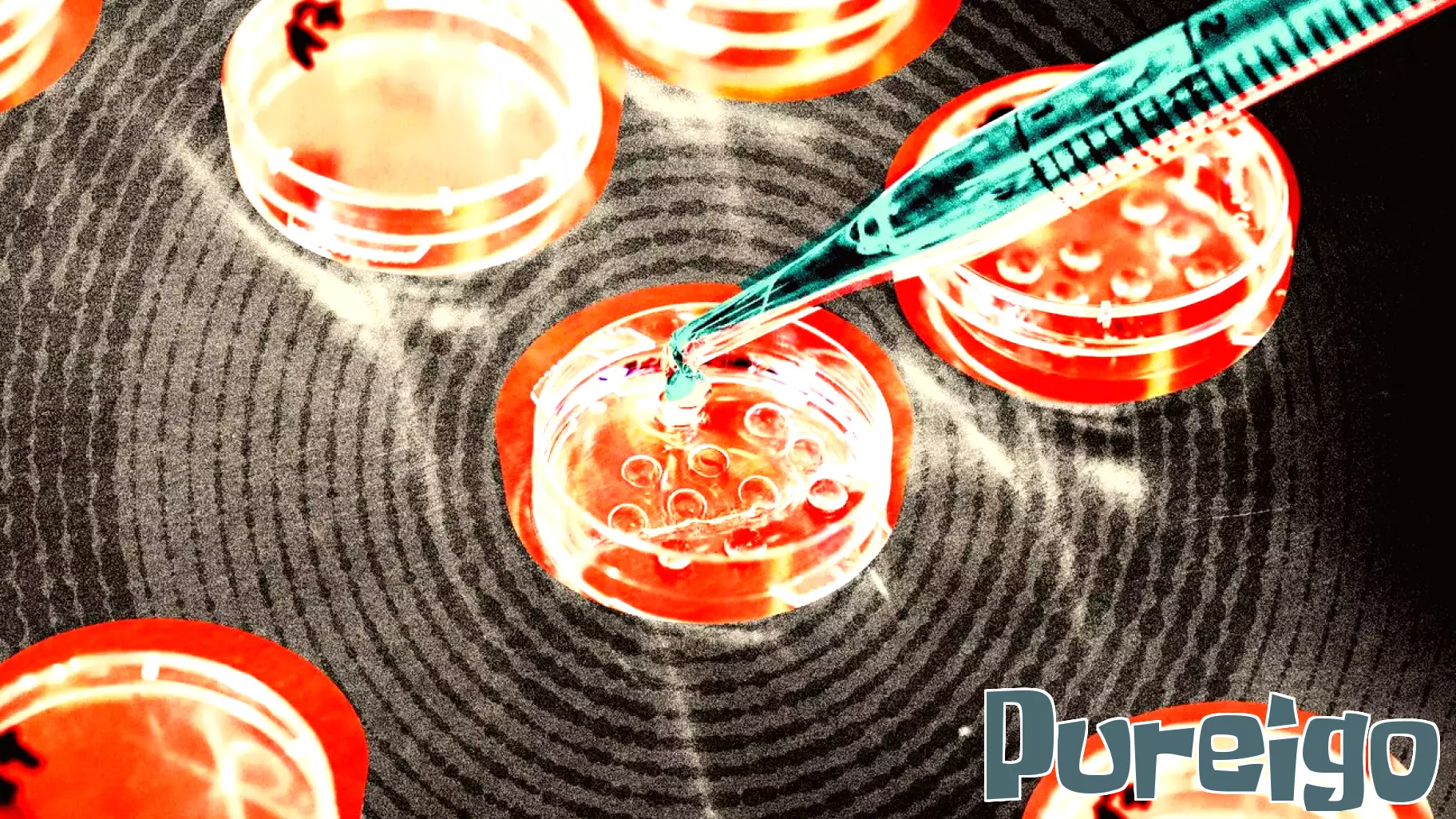 Growing Popularity of Elective IVF Raises Concerns Among Doctors