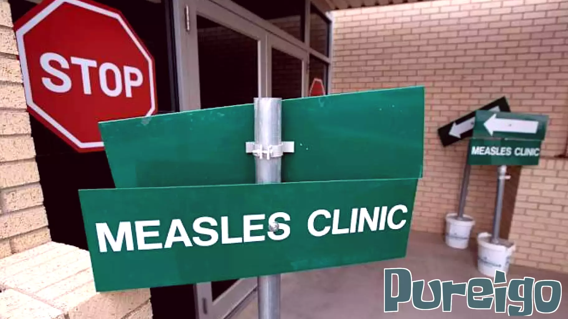 Houston Health Officials Alert Residents After Measles Exposure