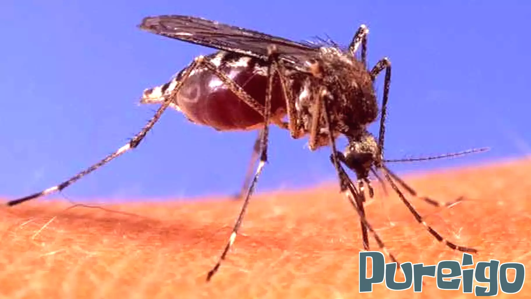 Human West Nile virus case confirmed in Worcester, health officials say