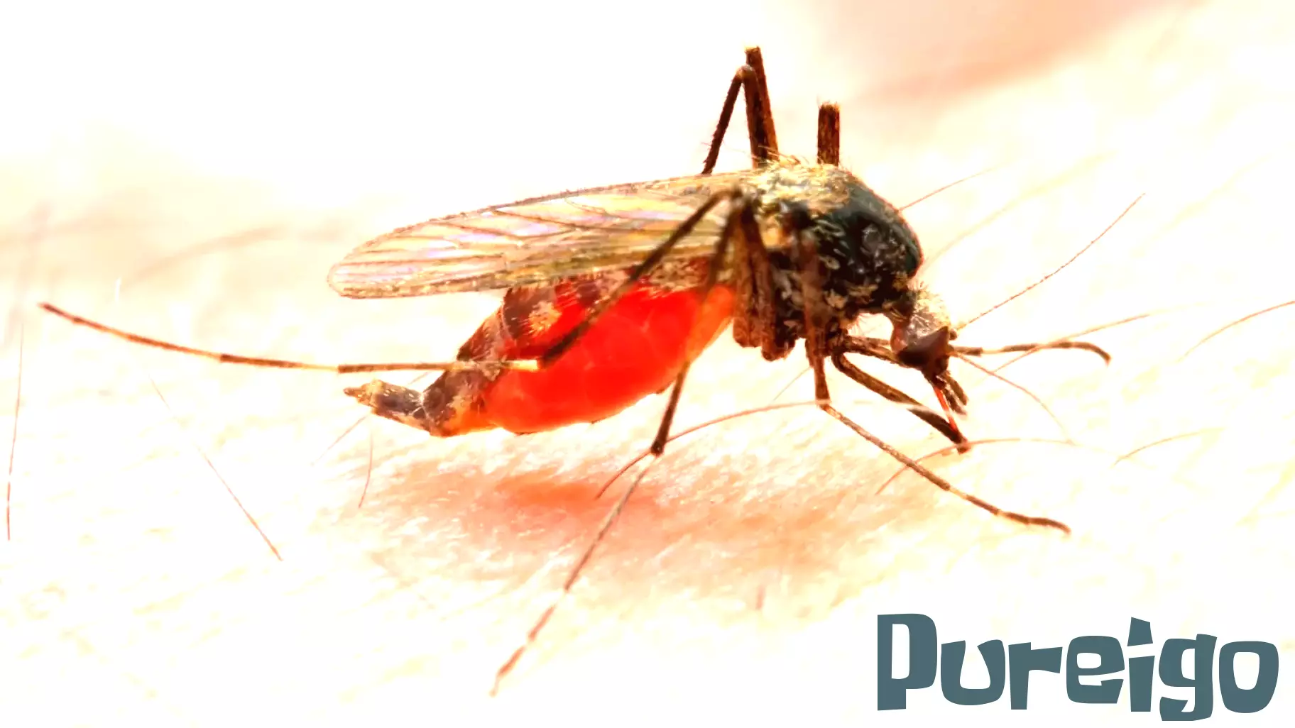 Investigating Potential Malaria Case in Morris County, New Jersey