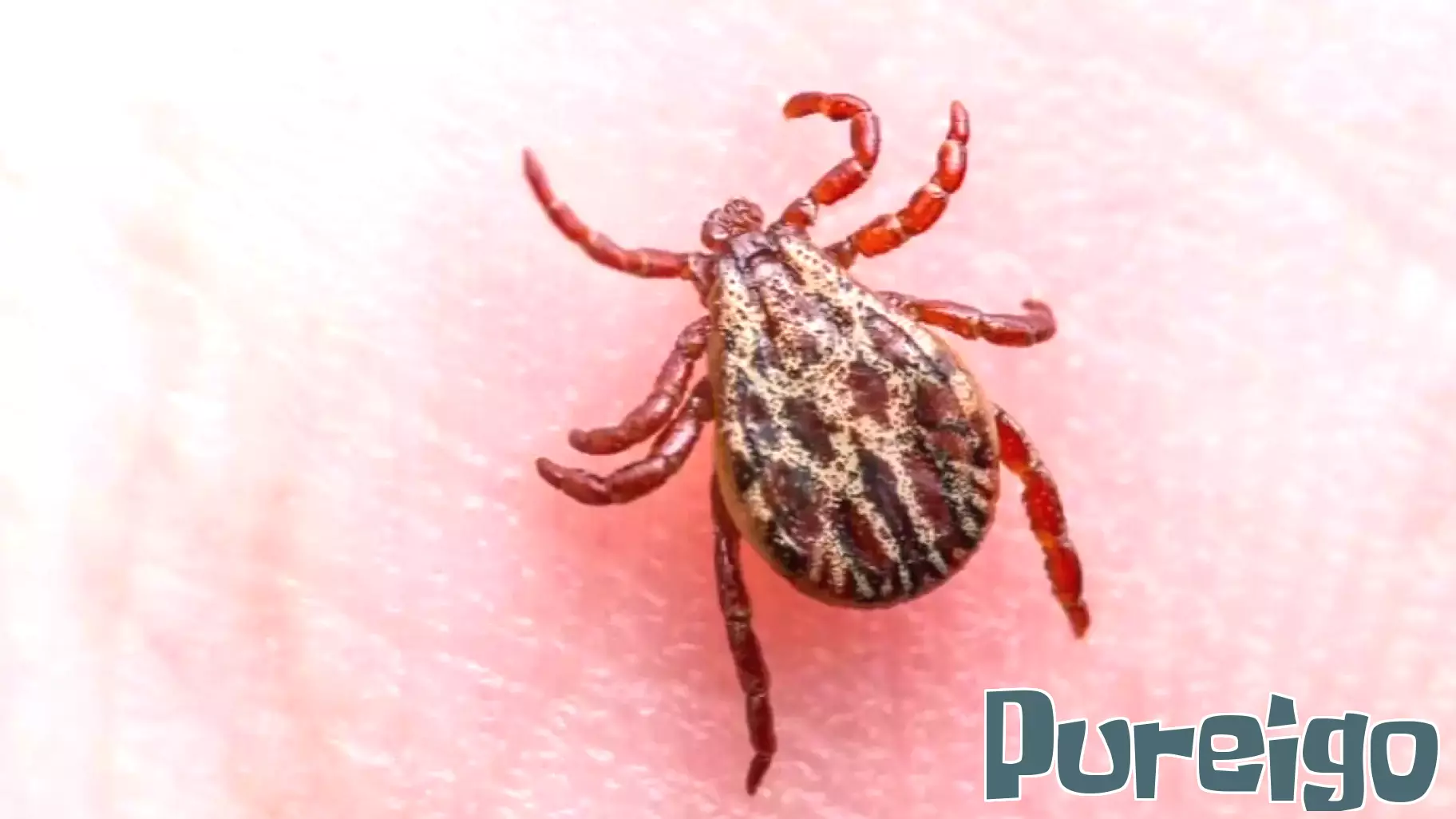 Tragic Tick-Borne Illness Claims Life in Floyd County, Indiana