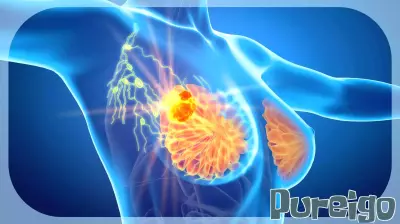 Canadian Approval for Adjuvant Ribociclib in Early Breast Cancer Treatment