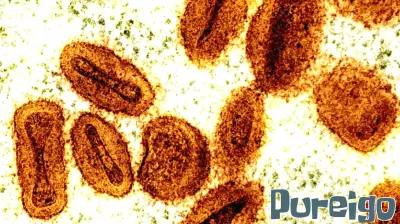 Rise in Mpox Cases in Massachusetts Raises Concerns