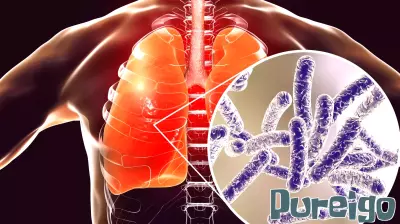 Update on Harlem Legionnaires' Disease Cluster Following Seventh Death